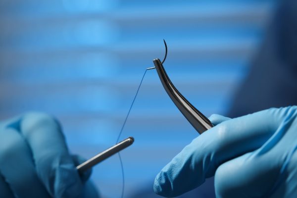 Absorbable vs Non-Absorbable Sutures: Understanding the Key Differences